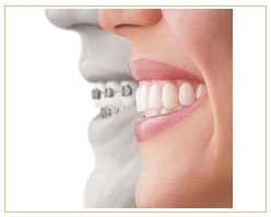 Slider image (8) PrimaDent Dental Center